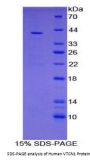 Human V-Set Domain Containing T-Cell Activation Inhibitor 1 (VTCN1) Protein