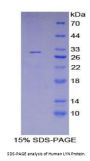 Human V-Yes-1 Yamaguchi Sarcoma Viral Related Oncogene Homolog (LYN) Protein