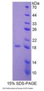 Human WNT1 Inducible Signaling Pathway Protein 1 / WISP1 (CCN4) Protein