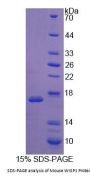 Mouse WNT1 Inducible Signaling Pathway Protein 1 / WISP1 (CCN4) Protein