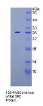 Rat Xeroderma Pigmentosum, Complementation Group C (XPC) Protein