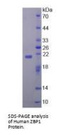 Human Z-DNA-Binding Protein 1 (ZBP1) Protein