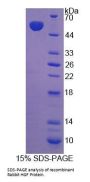 Rabbit Hepatocyte Growth Factor (HGF) Protein