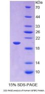 Human Insulin Like Growth Factor Binding Protein 2 (IGFBP2) Protein