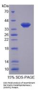 Rat Matrix Metalloproteinase 1 (MMP1) Protein