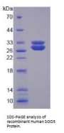 Human Superoxide Dismutase 3 (SOD3) Protein