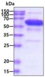 Human Catalase (CAT) Enzyme (Active)