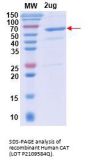 Human Catalase (CAT) Enzyme (Active)