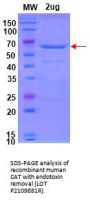 Human Catalase (CAT) Enzyme (Active)