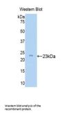 Zyxin Antibody