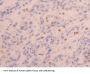 Zyxin Antibody