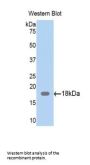 Zyxin Antibody