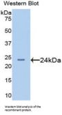 Afamin (AFM) Antibody