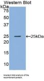 Noggin (NOG) Antibody