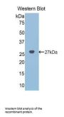 Noggin (NOG) Antibody