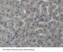 Noggin (NOG) Antibody