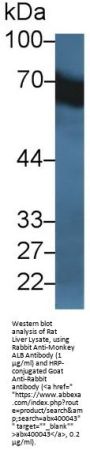 Albumin (ALB) Antibody