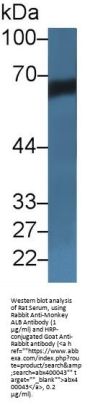 Albumin (ALB) Antibody