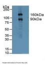 Gelsolin (GSN) Antibody