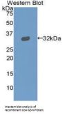 Gelsolin (GSN) Antibody