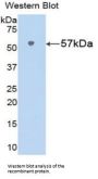 Nicotinamide Phosphoribosyltransferase / Visfatin (NAMPT) Antibody
