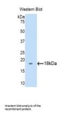 Biglycan (BGN) Antibody