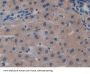 Biglycan (BGN) Antibody