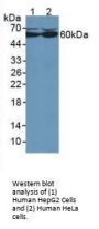 Catalase (CAT) Antibody