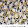 Dymeclin (DYM) Antibody