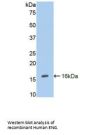 Endoglin / CD105 (ENG) Antibody