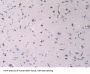 Endoglin / CD105 (ENG) Antibody