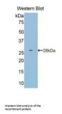 Granulin (GRN) Antibody