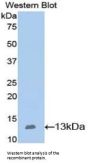 Nephrin (NPHN) Antibody