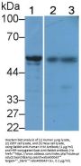Vimentin (VIM) Antibody