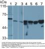 Vimentin (VIM) Antibody