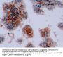 Vimentin (VIM) Antibody