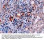Vimentin (VIM) Antibody