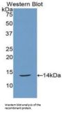 Calcitonin (CALCA) Antibody