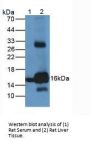 Hemoglobin (HB) Antibody