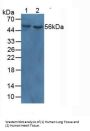 Myocilin (MYOC) Antibody