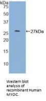 Myocilin (MYOC) Antibody