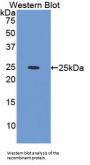 Caldesmon (CALD1) Antibody