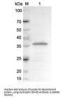 Dystrophin (DMD) Antibody