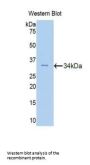 Fascin 2 Antibody