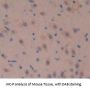 Fascin 2 Antibody