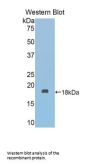 Fascin 2 (FSCN2) Antibody