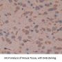 Fascin 2 (FSCN2) Antibody