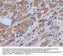 Fibronectin (FN) Antibody