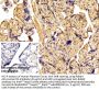 Fibronectin (FN) Antibody