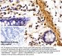 Fibronectin (FN) Antibody
